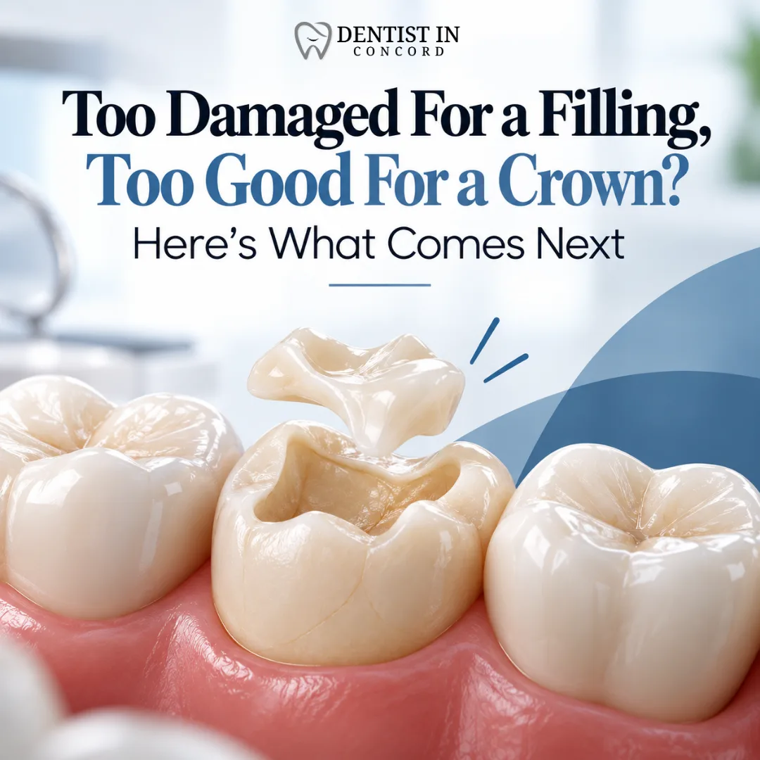 Too Damaged For A Filling, Too Good For A Crown? Here's What Comes Next