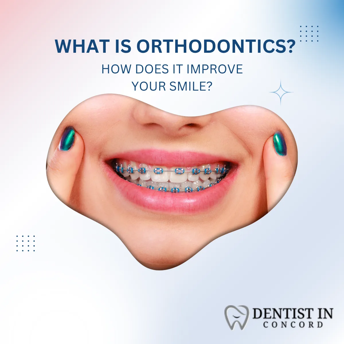 What Is Orthodontics and How Does It Improve Your Smile?