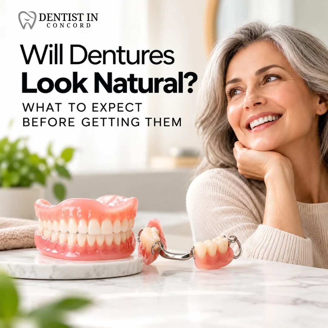 Will Dentures Look Natural? What to Expect Before Getting Them