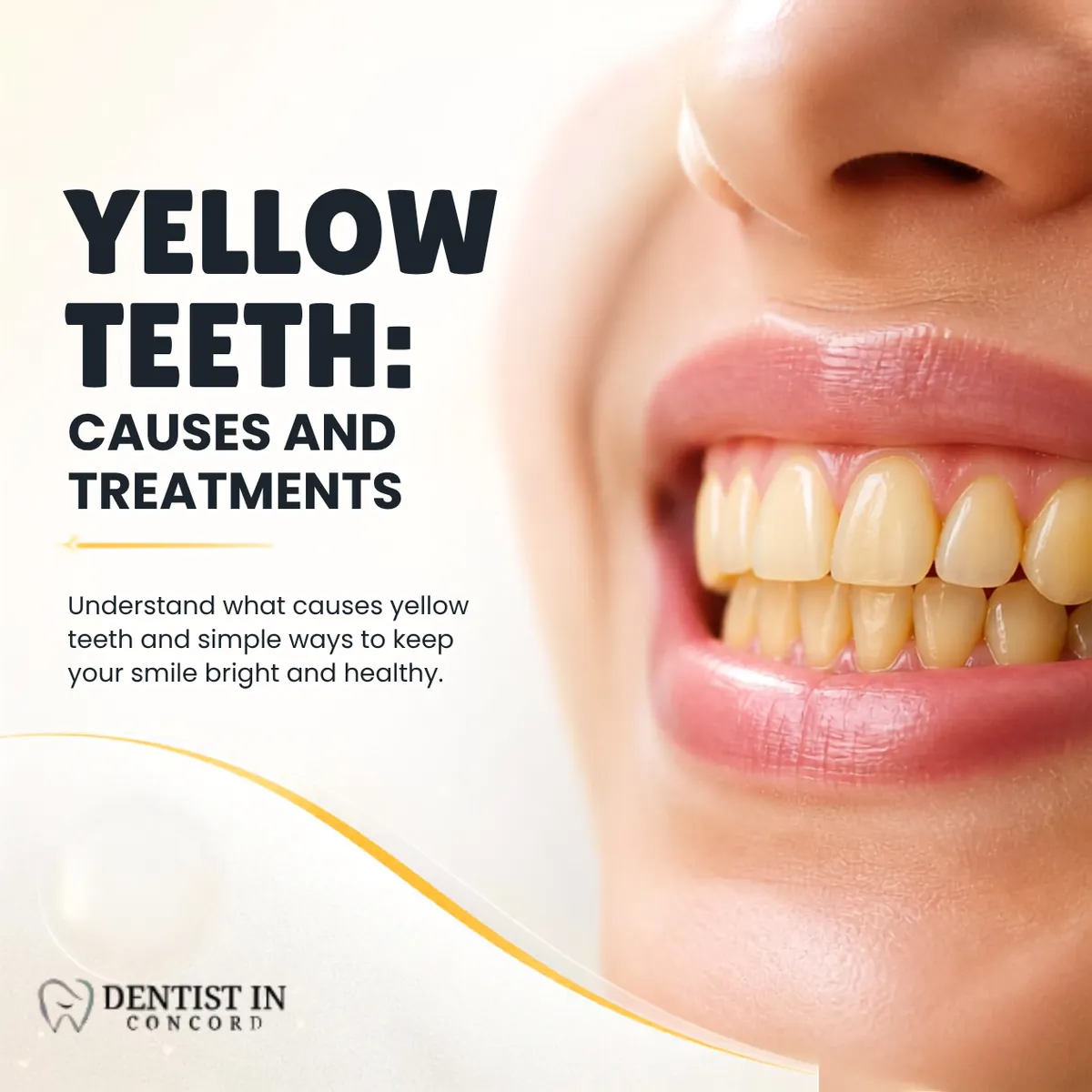 Yellow Teeth Causes and Treatments Explained