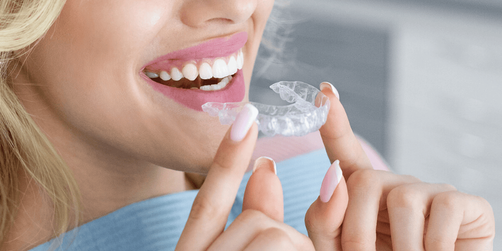 Orthodontic Treatment Options